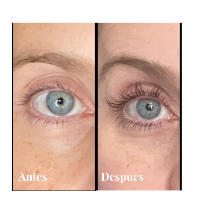 VIVE LASH SERUM - Experts Eyelash Enhancer 5mL